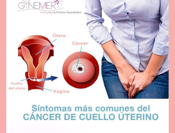 Síntomas del Cáncer cervicouterino