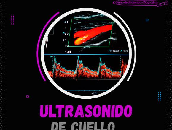 Ultrasonido de Cuello