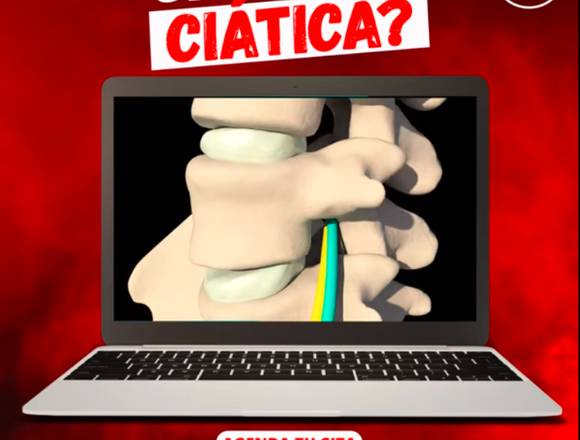 🥵 ¿Dolor de Ciática? 🦵