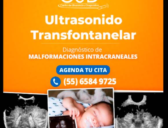 ULTRASONIDO TRANSFONTANELAR