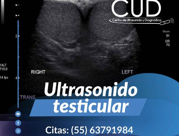 ULTRASONIDO TESTICULAR