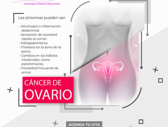 Síntomas del Cáncer de Ovario