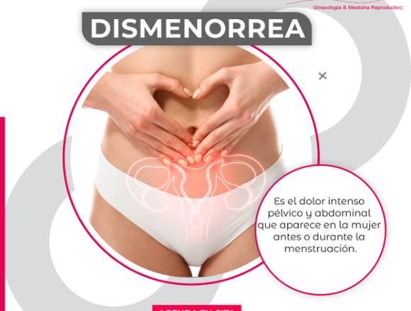 ¿Qué es la Dismenorrea?