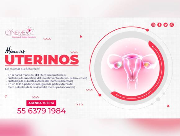 ¿Qué son los Miomas Uterinos?