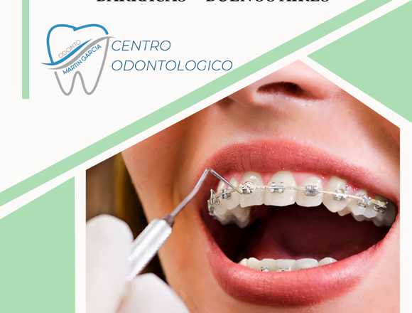 Ortodoncia Braquets Esteticos