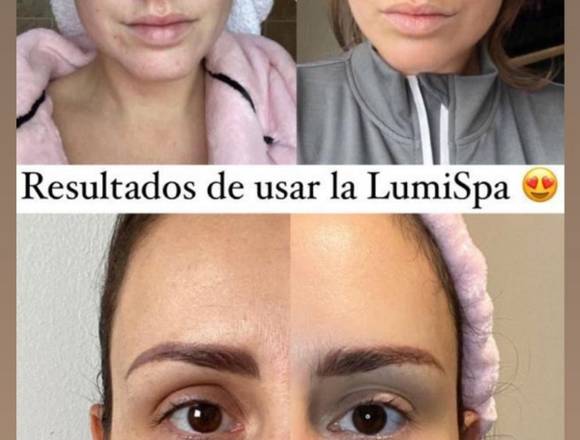 lumispa dermolimpiadora