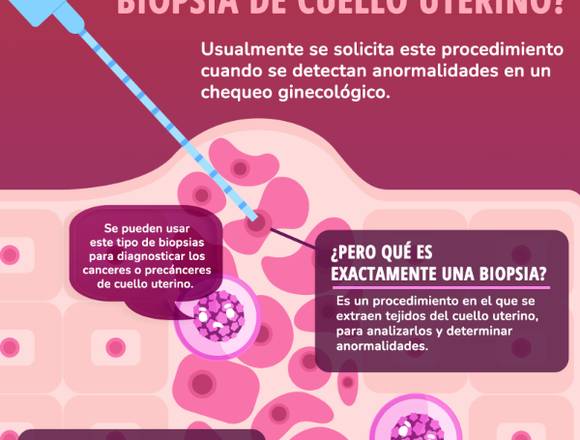 ¿Biopsia de CUELLO UTERINO?