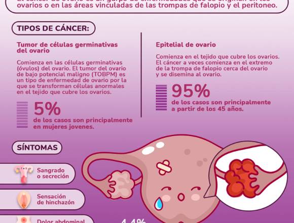 ¿Qué saber sobre el CÁNCER DE OVARIO?