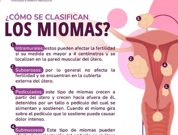 Como se clasifican los MIOMAS 