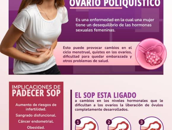 ¿Qué es el SINDROME DE OVARIO POLIQUÍSTICO?