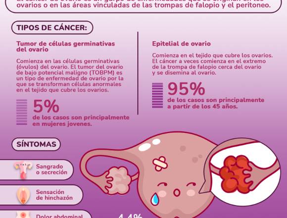 Qué es el CÁNCER DE OVARIO 