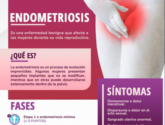 ¿Qué debo saber sobre la ENDOMETRIOSIS?