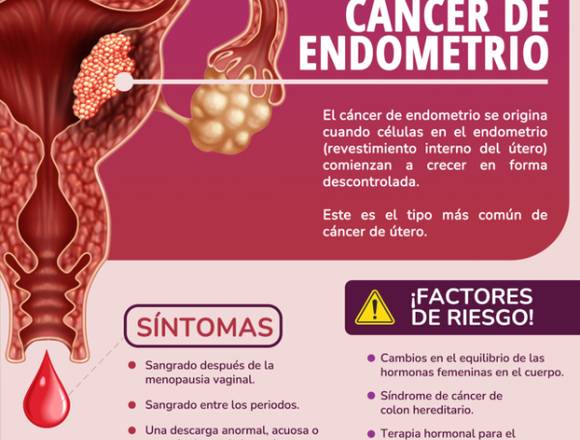 Informate sobre el CÁNCER DE ENDOMETRIO