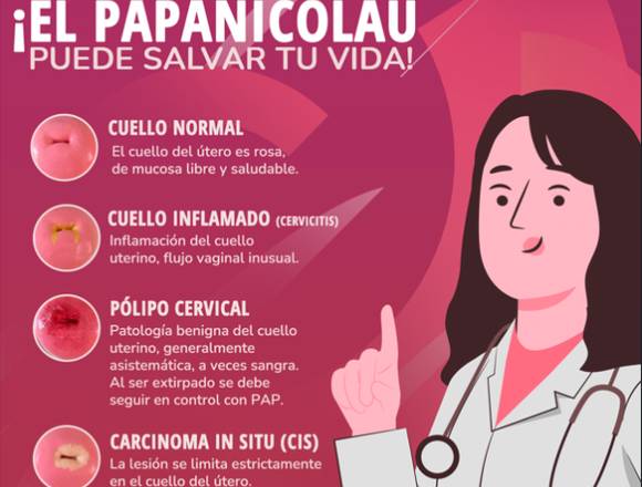 ¿Qué es el PAPANICOLAU?