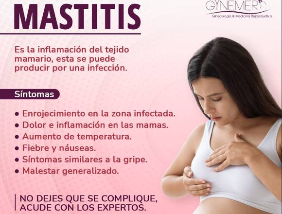 Síntomas de MASTÍTIS 