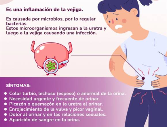 ¿Inflamación de vejiga?