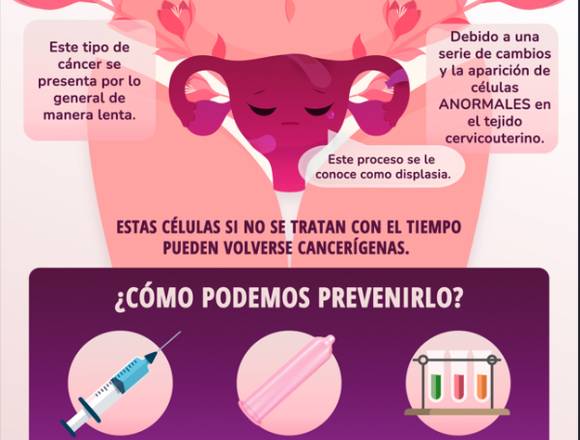 ¿Cómo prevenir el cáncer de CUELLO UTERINO?