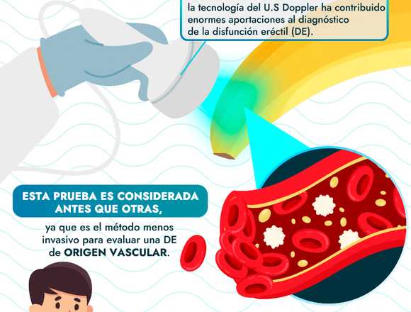 Ultrasonido doppler de cuerpos cavernosos