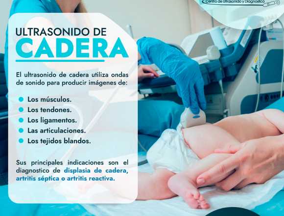 Ultrasonido de Cadera pediatrico