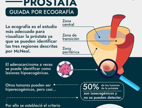 Biopsia de próstata guiada por ecocrafía  