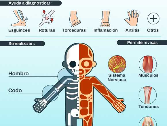 ¿Que detecta un ultrasonido musculo esqueletico?