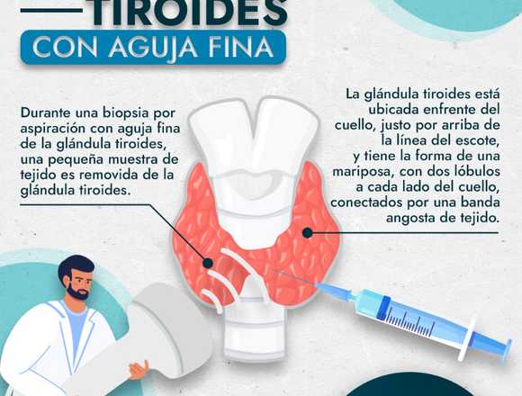 Biopsia de tiroides guiada por ultrasonido