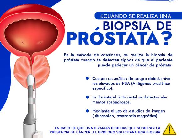 ¿Cuando se debe realizar una biposia de prostata?