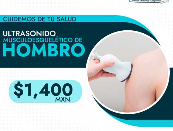 ¡Ultrasonido de Hombro!