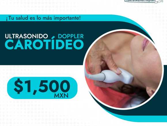 ¡ULTRASONIDO DOPPLER CAROTIDEO!