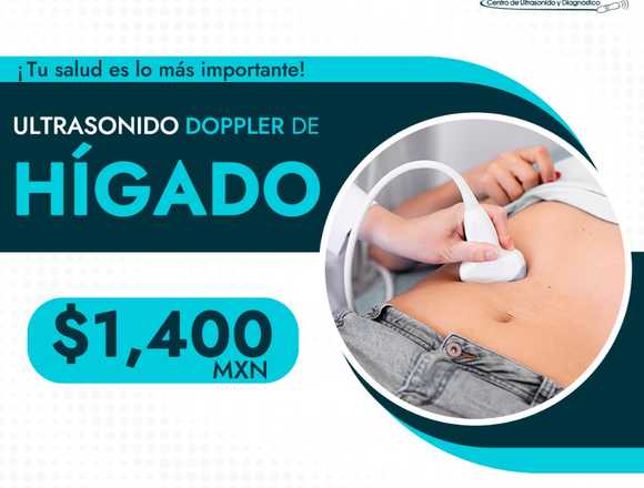 ULTRASONIDO DOPPLER DE HIGADO