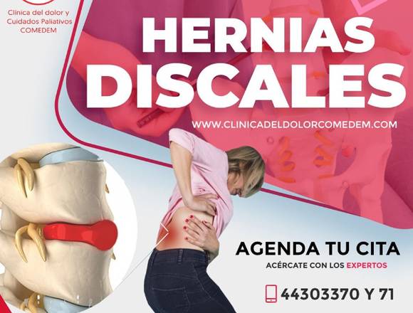  La hernia de disco 