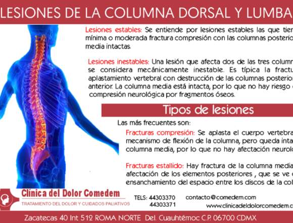 clínica del dolor Lesiones de la columna 