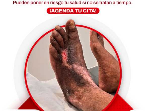 ¿Problemas vasculares?