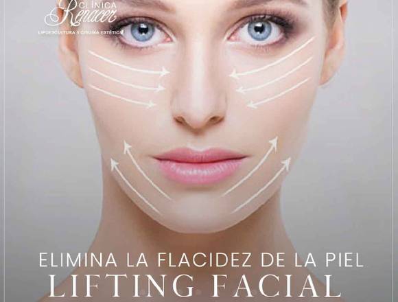 LIFTING FACIAL BENEFICIOS