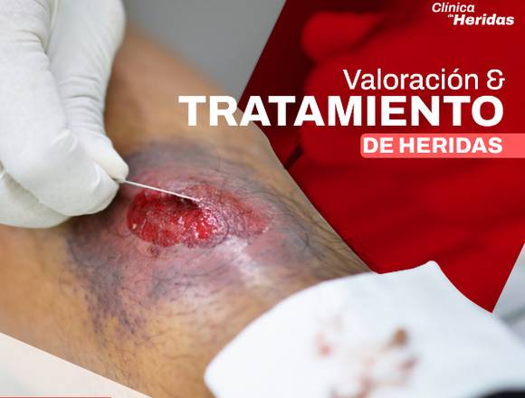 Valoración y tratamiento de heridas