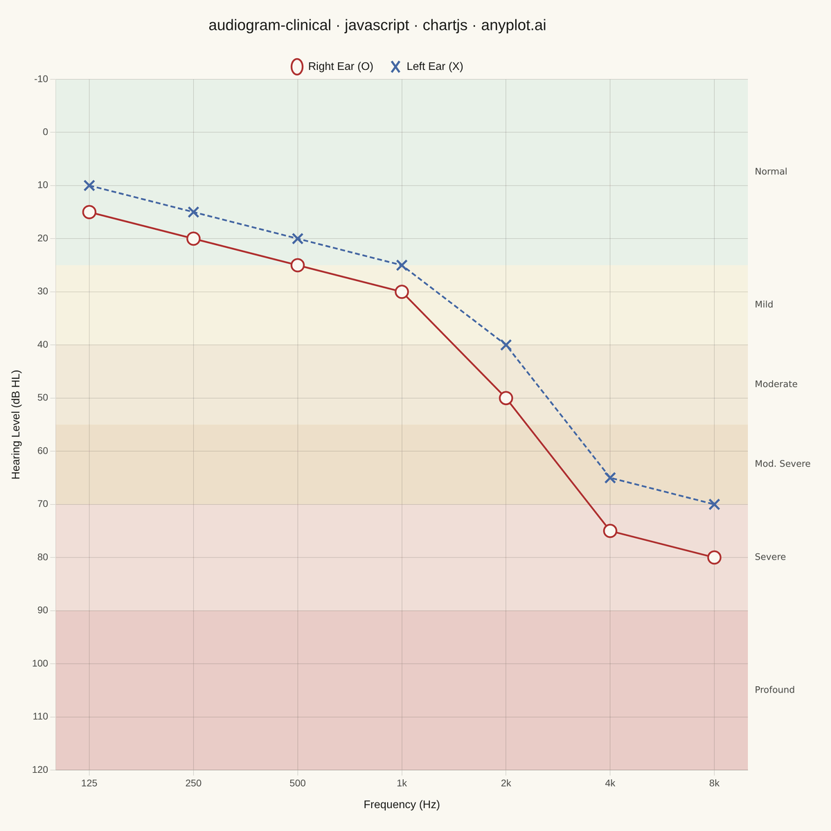 Clinical Audiogram rendered with Chart.js