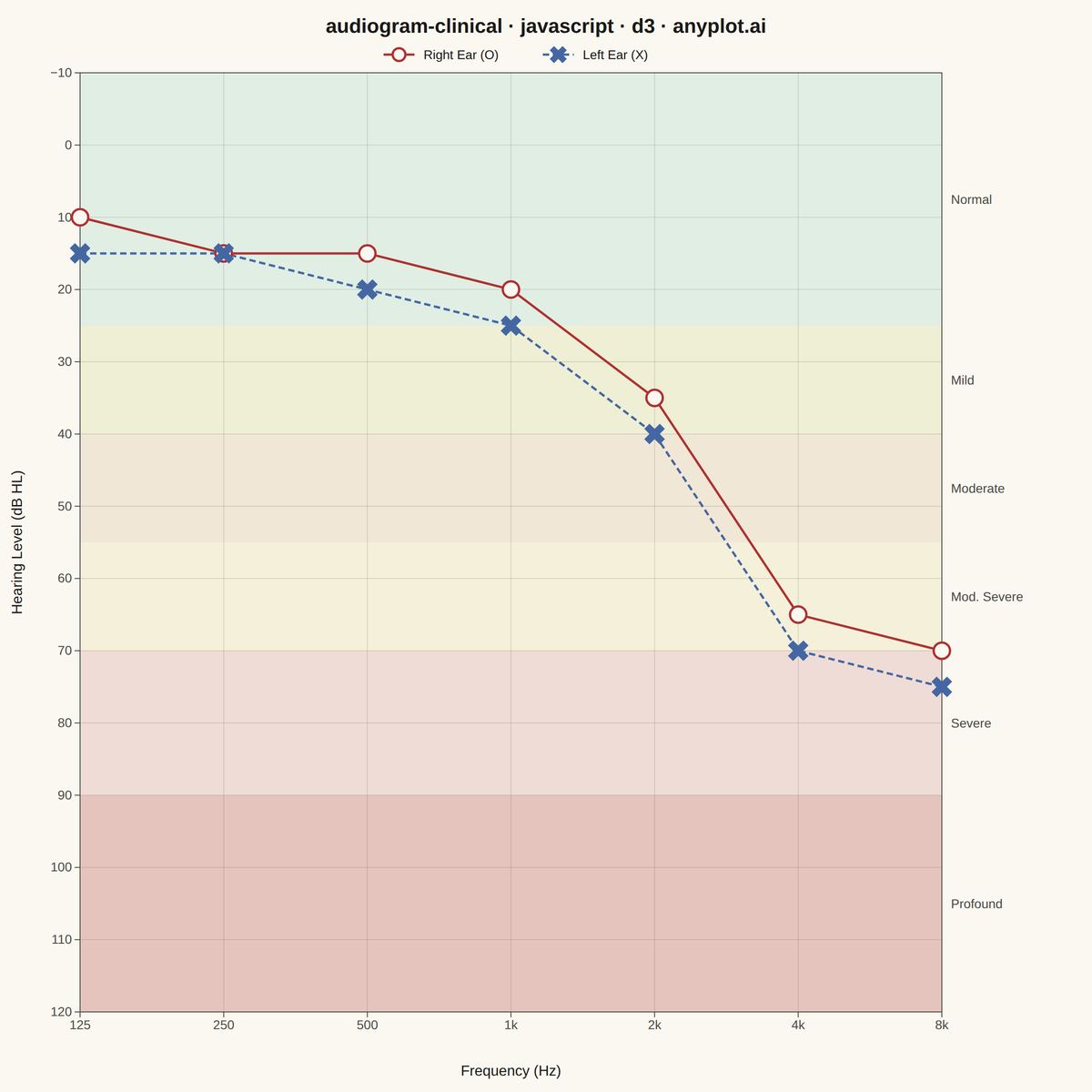 Clinical Audiogram rendered with D3.js