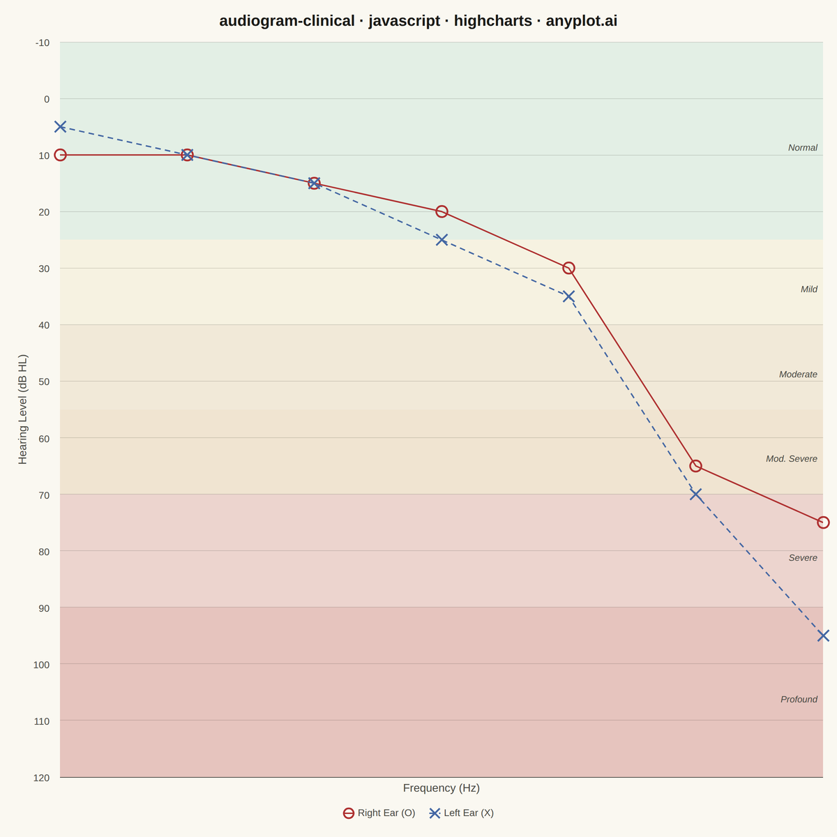 Clinical Audiogram rendered with Highcharts