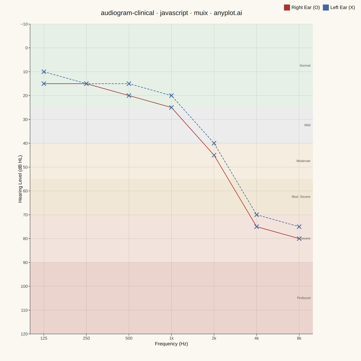 Clinical Audiogram rendered with MUI X Charts