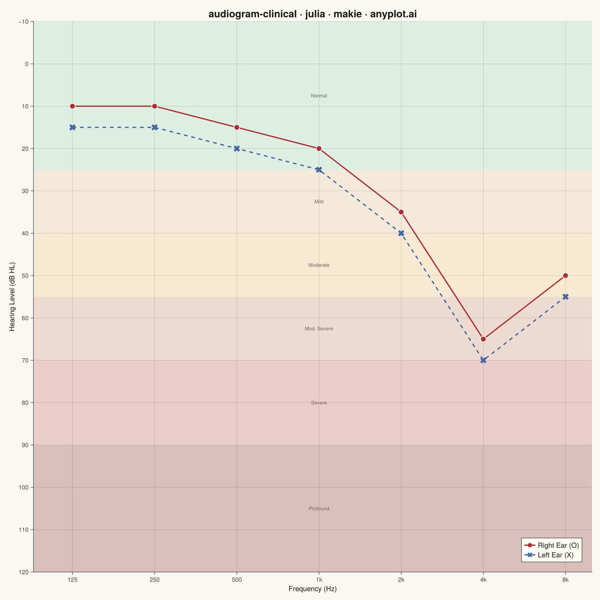 Clinical Audiogram rendered with Makie.jl