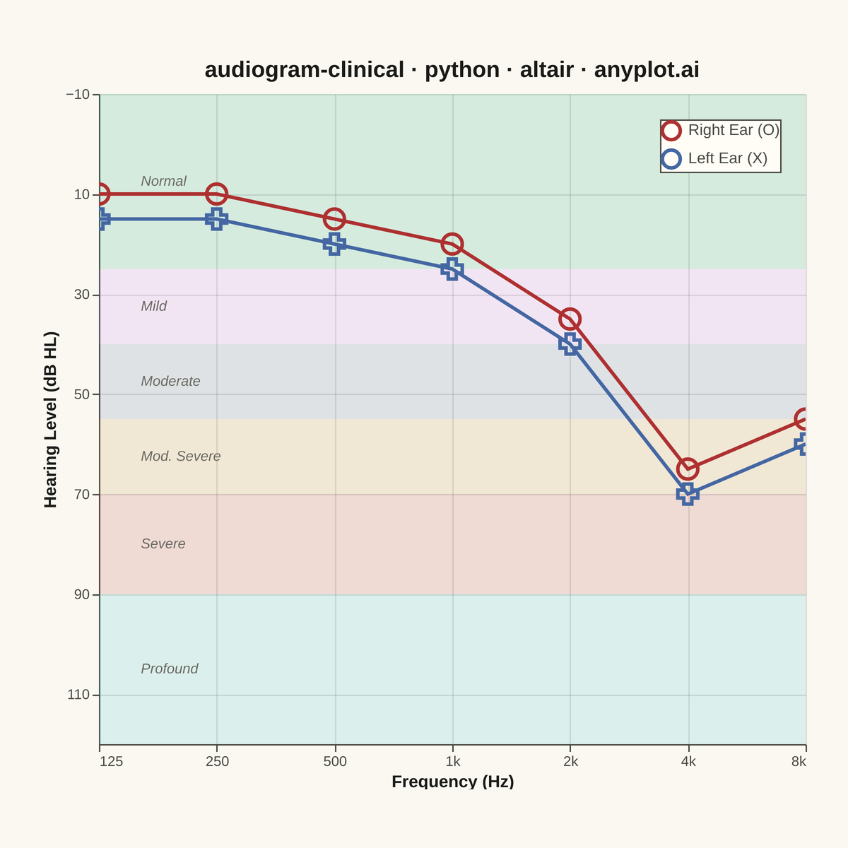 Clinical Audiogram rendered with Altair