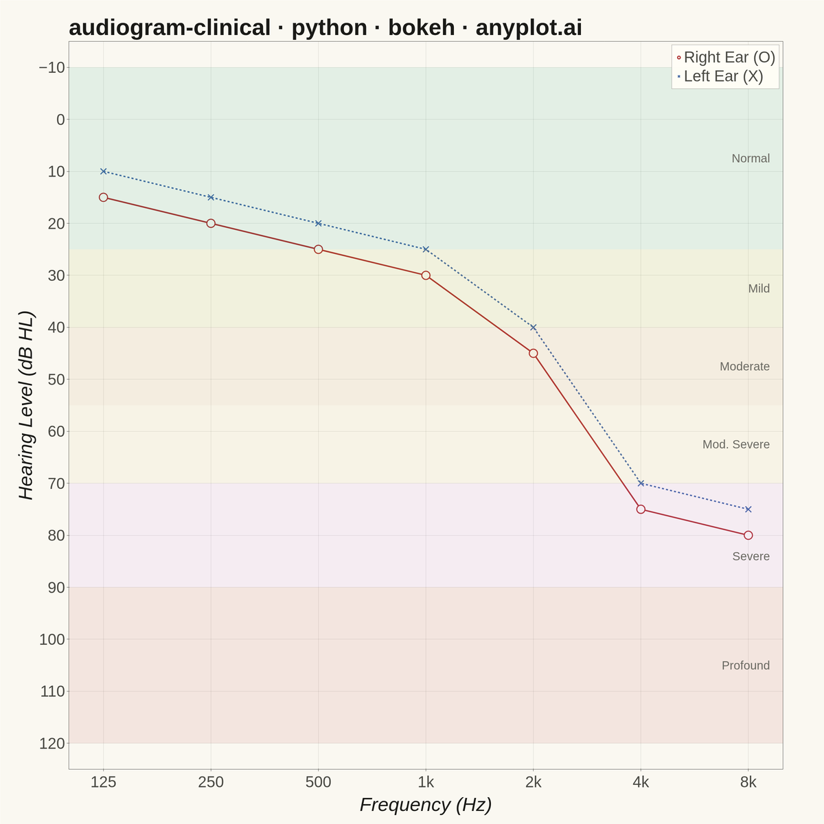 Clinical Audiogram rendered with Bokeh