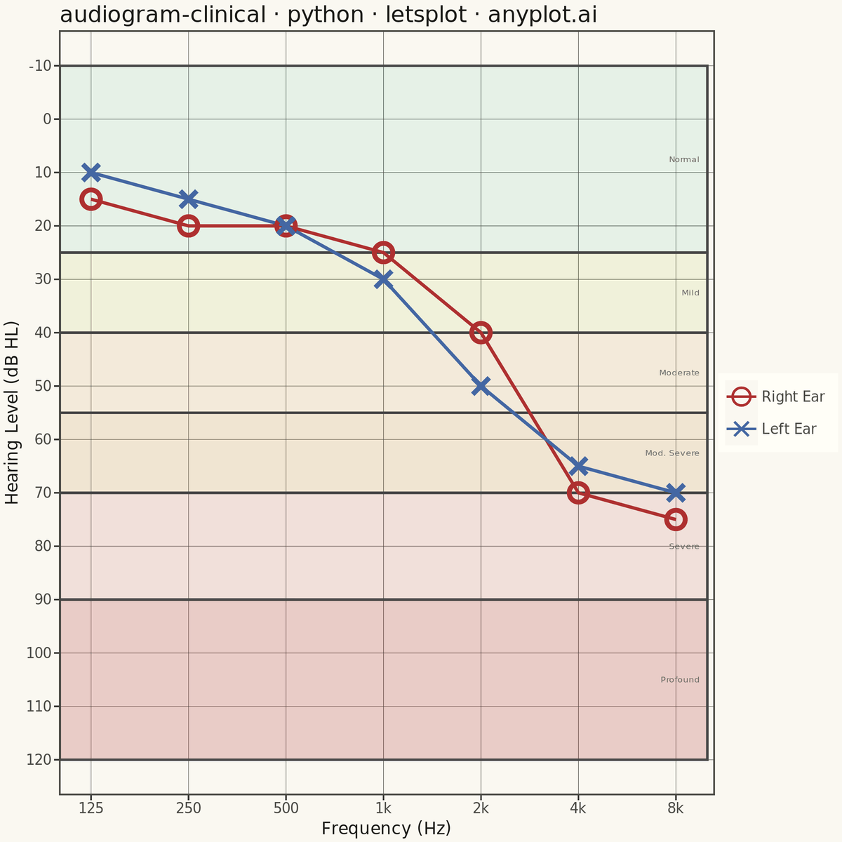 Clinical Audiogram rendered with lets-plot