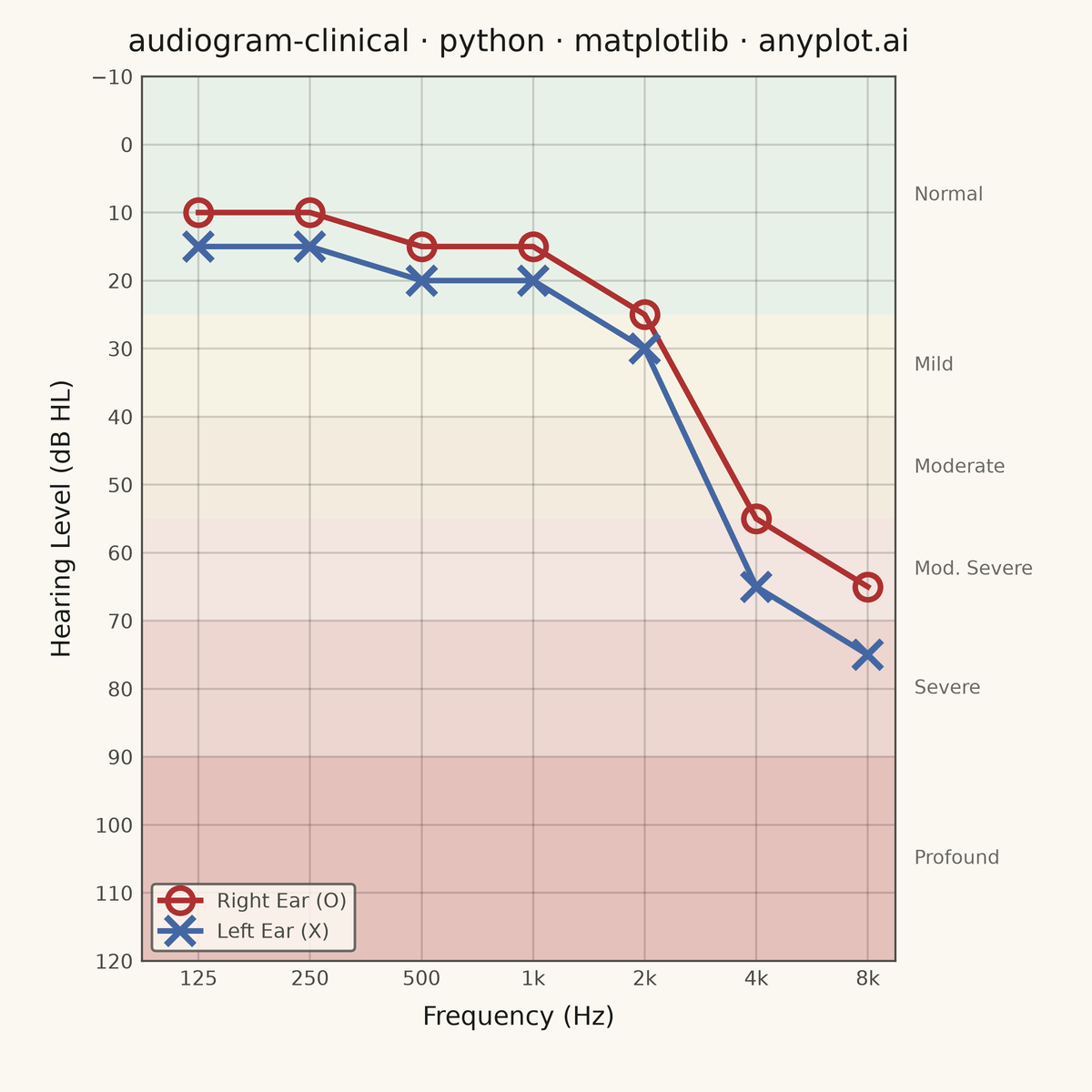 Clinical Audiogram rendered with Matplotlib