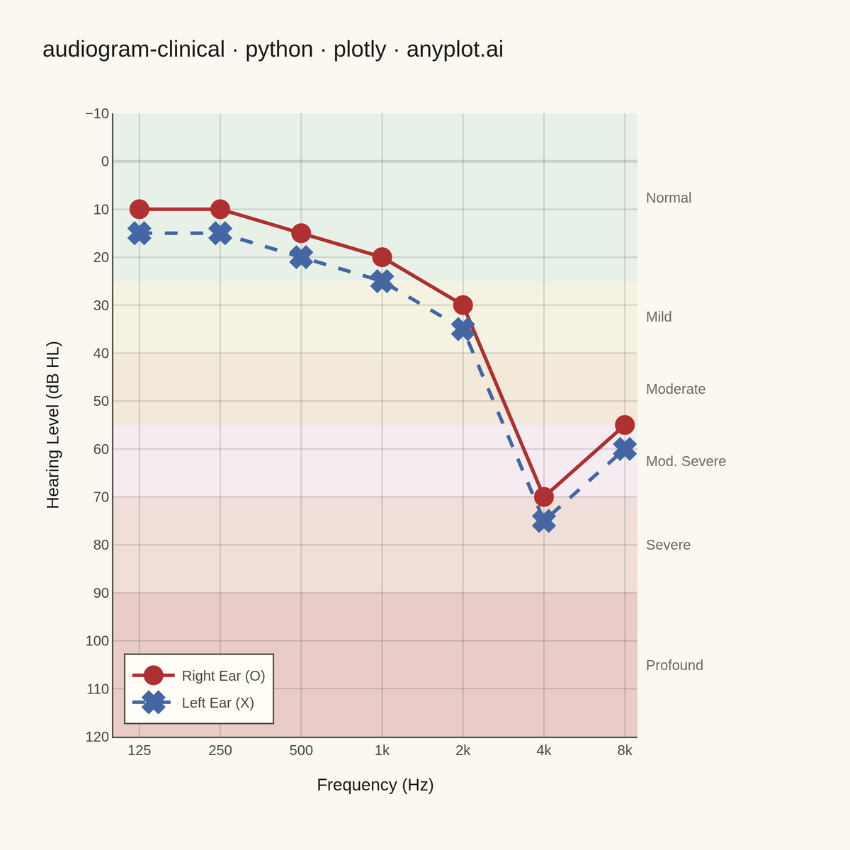 Clinical Audiogram rendered with Plotly