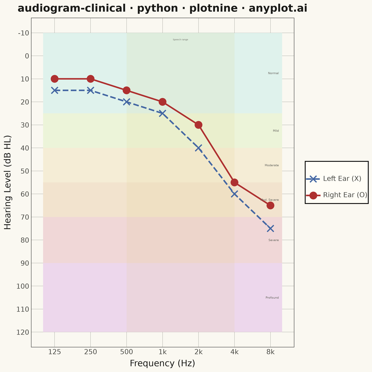 Clinical Audiogram rendered with plotnine
