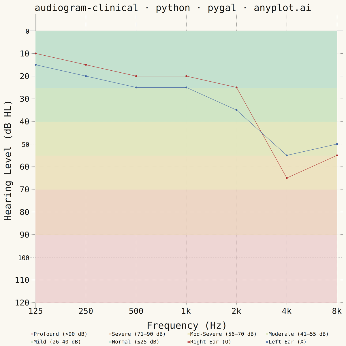 Clinical Audiogram rendered with Pygal
