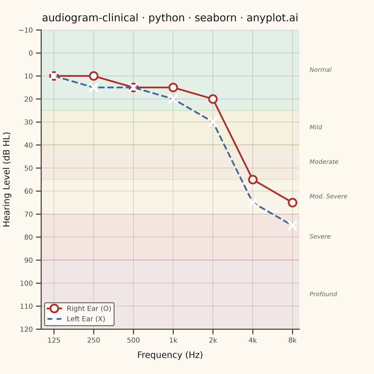 Clinical Audiogram rendered with Seaborn