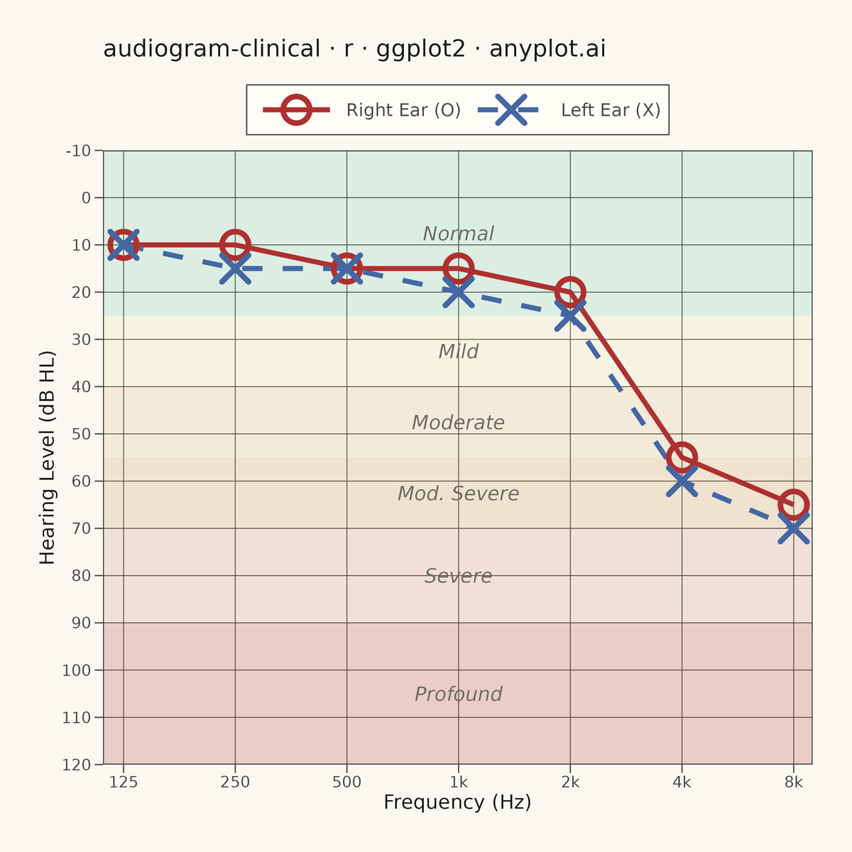 Clinical Audiogram rendered with ggplot2