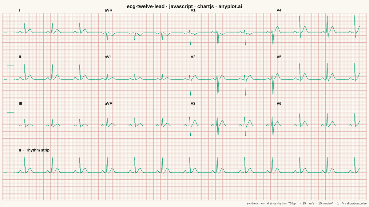 ECG/EKG 12-Lead Waveform Display rendered with Chart.js